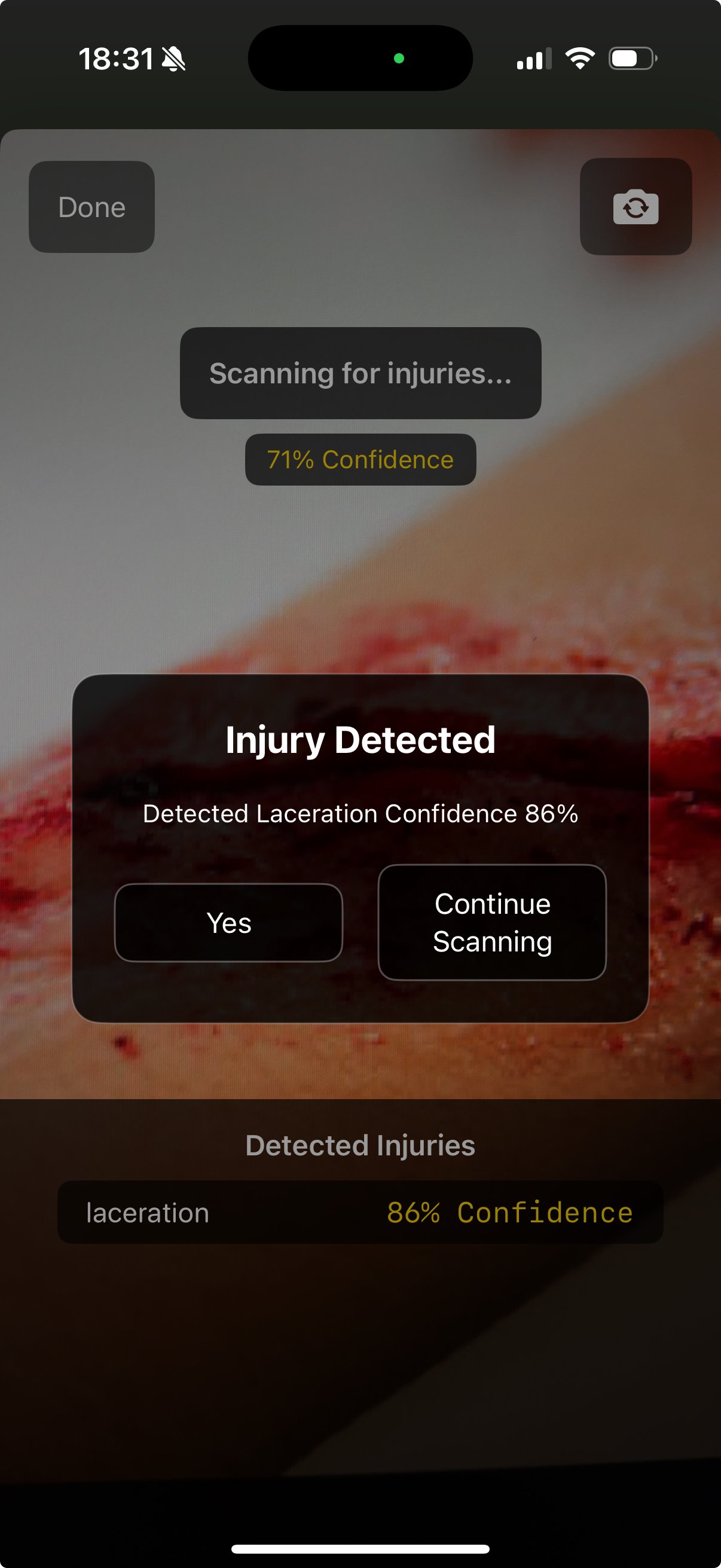 Injury detected screen